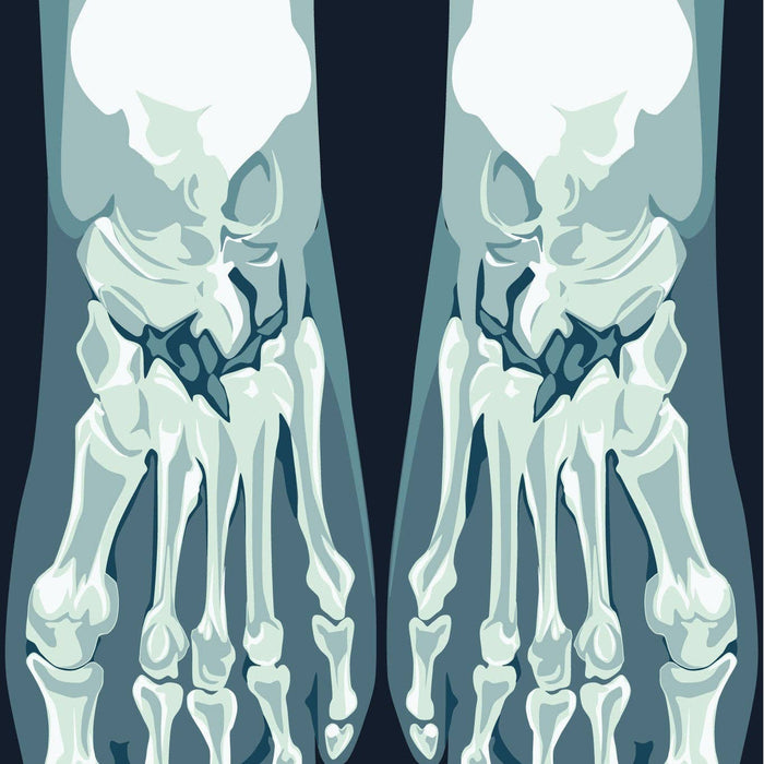 Skeletoes X-ray sukat - FootClothes